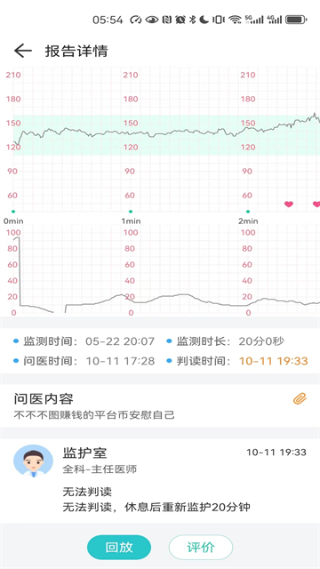 胎心监护图2