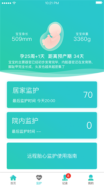 胎心监护图3